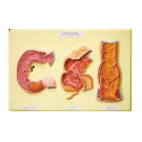 Барельефная модель Толстая и тонкая кишка (внутренняя поверхность)